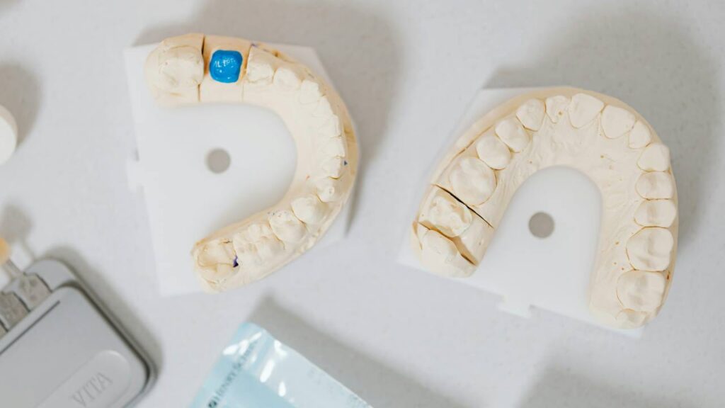 Dentista_Protesi_pexels-karolina-grabowska