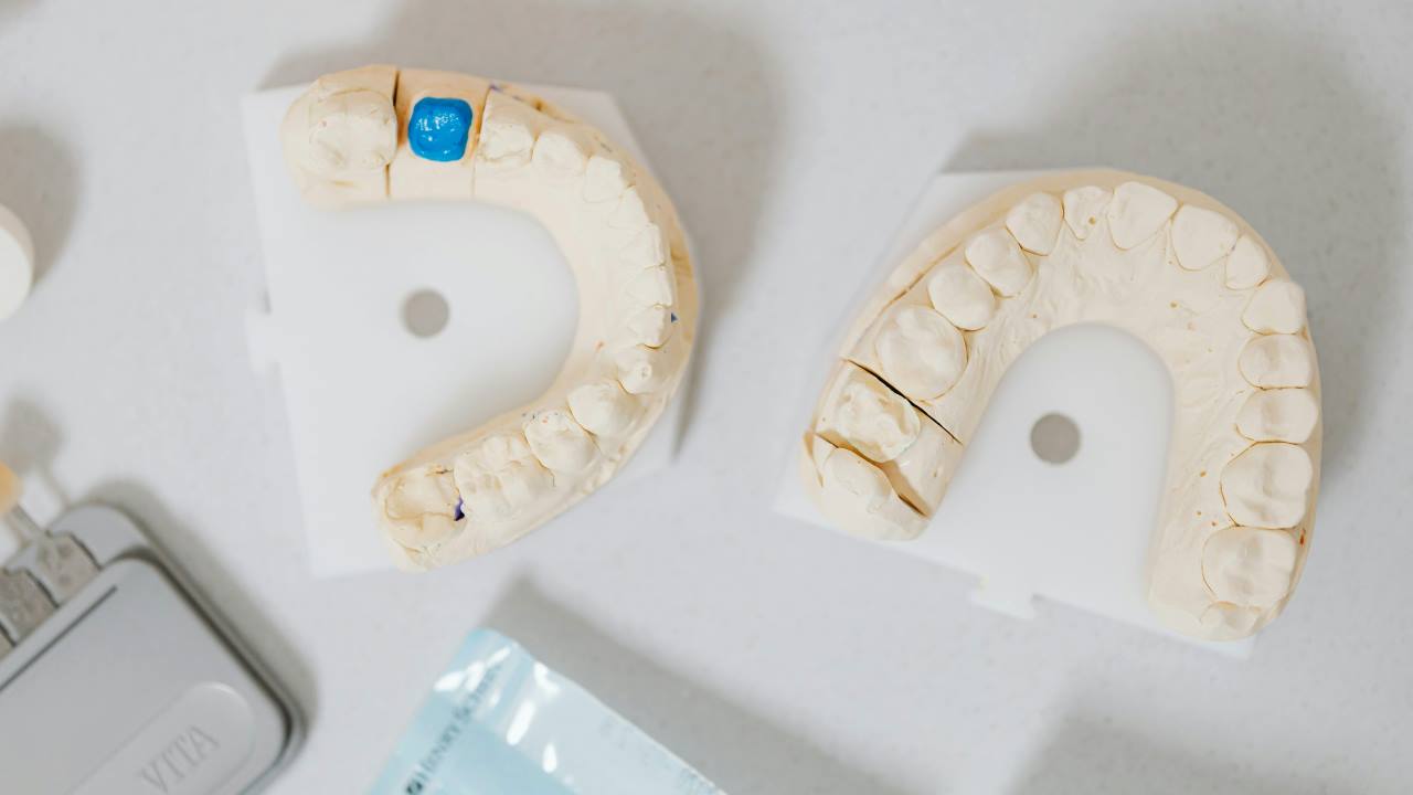 Dentista_Protesi_pexels-karolina-grabowska