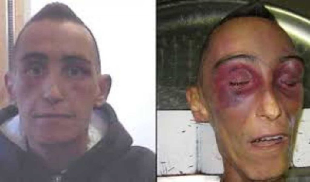 stefano cucchi