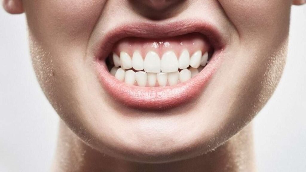 Malocclusione dentale