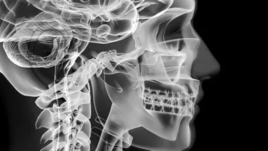 Radiografia del cranio