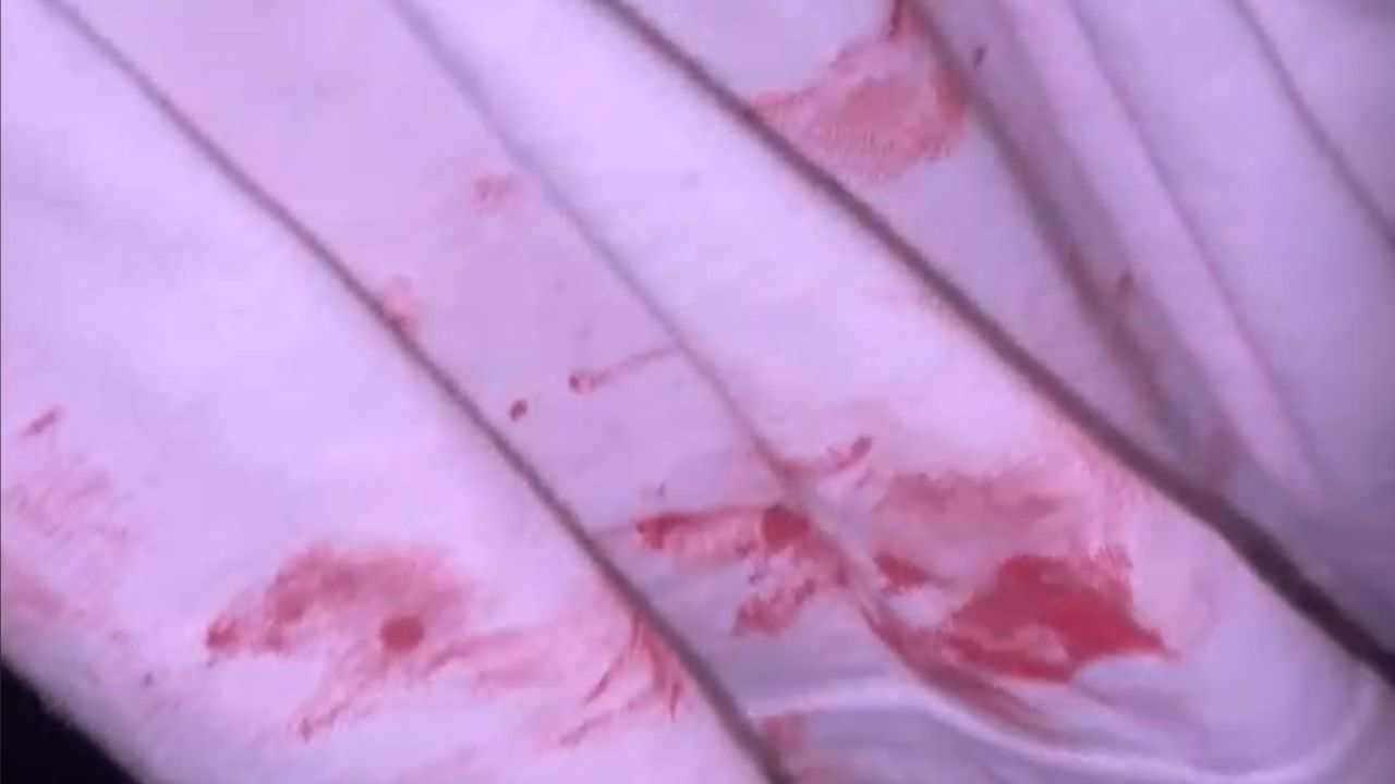 Maglietta insanguinata del ragazzo aggredito al Circeo