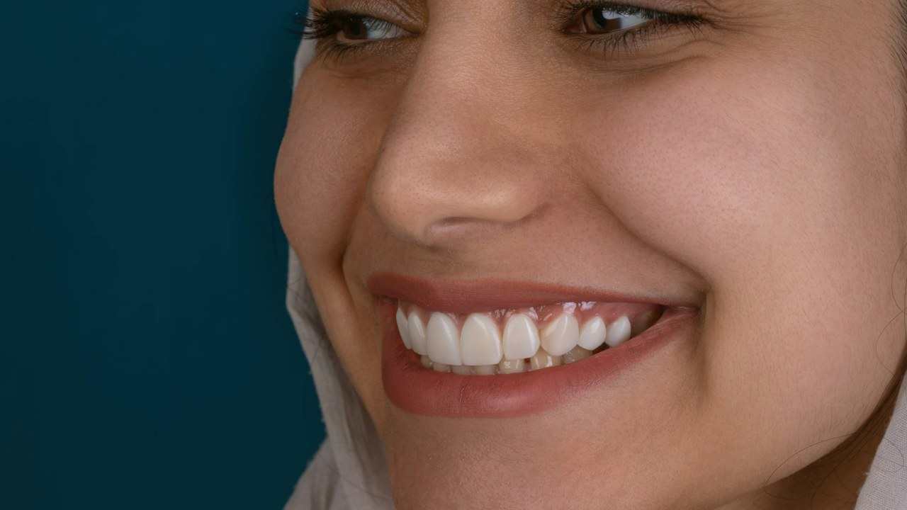 Sorriso di donna, denti, kamal, hoseinianzade, unsplash
